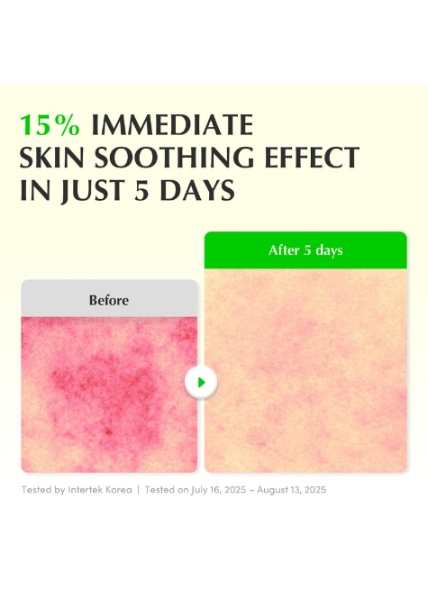 Eqqualberry Aloe PDRN Calming Serum 30ml