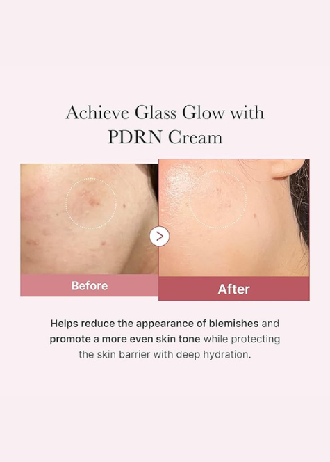 Medicube PDRN Pink Hyaluronic Moisturizing Cream 50ml